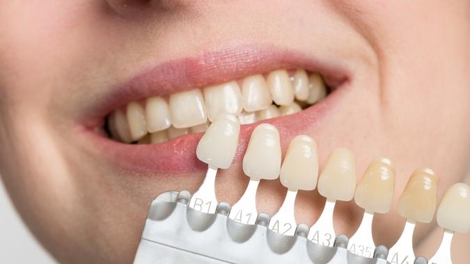 Co zrobić, żeby mieć białe zęby?